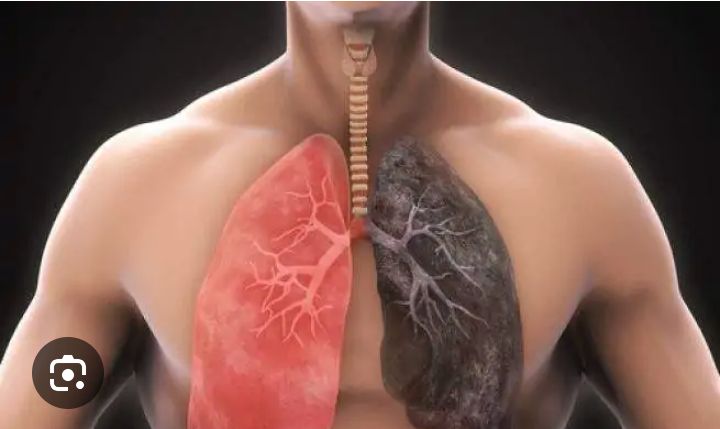 Umurwayi wo muri Australia yahinduriwe ibihaha hifashishijwe ikorana buhanga rya Ai mugihe kingana n'amasaha 48 icyo gikorwa kiri gikorwa  